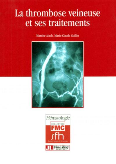 La thrombose veineuse et ses traitements