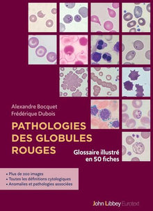 Pathologies des globules rouges