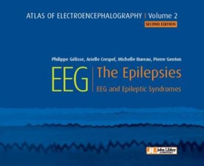 Atlas of electroencephalography - Volume 2