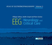 Atlas of Electroencephalography - Volume 3