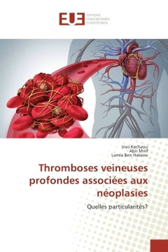 Thromboses veineuses profondes associees aux neoplasies