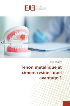 Tenon métallique et ciment résine : quel avantage ?