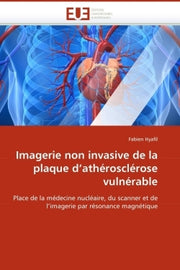 Imagerie non invasive de la plaque d'athérosclérose vulnérable