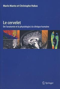 Le cervelet