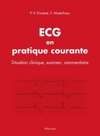 ECG en pratique courante