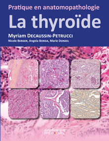 La thyroïde