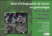 Le cancer du col et le cancer de l'endomètre. Atlas d'échographie fusion en gynécologie