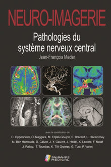 Neuro-imagerie. Pathologies du système nerveux central 2ed