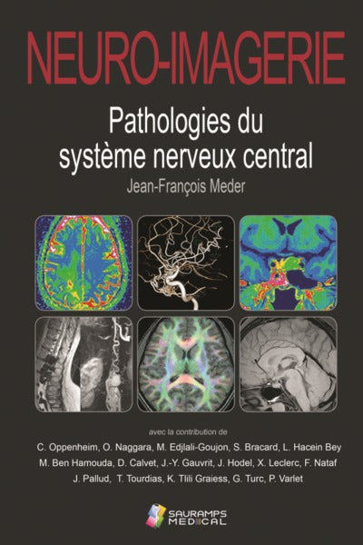 Neuro-imagerie. Pathologies du système nerveux central 2ed