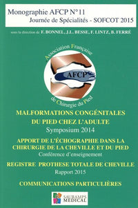 Malformations congénitales du pied chez l'adulte
