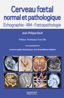 Cerveau foetal normal et pathologique -Echographie, IRM, Foetopathologie