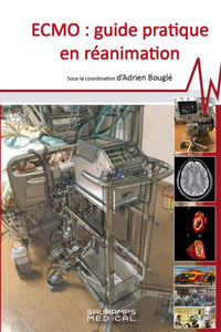 ECMO - Guide pratique de réanimation