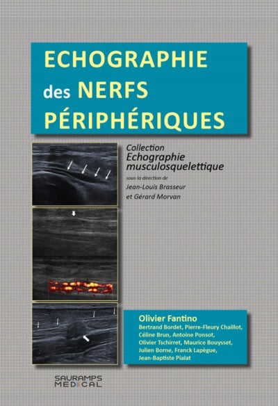 Echographie des nerfs périphériques