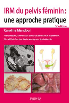 IRM du pelvis féminin : une approche pratique 3e ed