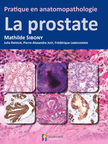 Pratique en anatomopathologie - la prostate