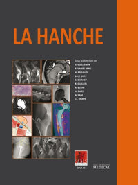 La hanche