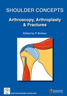 Shoulder Concepts Arthroscopy Arthroplasty & Fractures