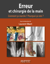 Erreur et chirurgie de la main