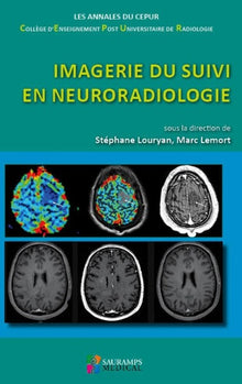 Imagerie du suivi en neuroradiologie