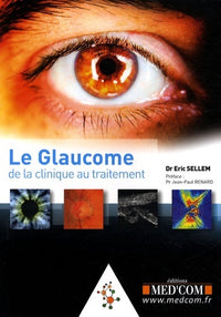 Le glaucome