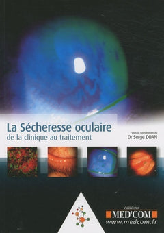 La sécheresse oculaire