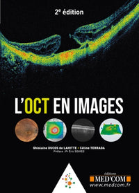 L'oct en images