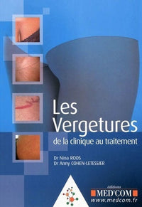 Les vergetures