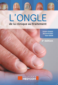 L'ongle