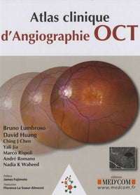 Atlas d'angiographie. OCT clinique