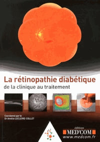 La rétinopathie diabétique : de la clinique au traitement