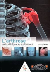 L'arthrose : de la clinique au traitement