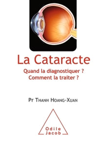 La cataracte