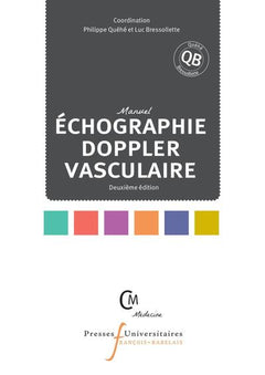Échographie doppler vasculaire