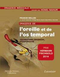 Imagerie de l'oreille et de l'os temporal - Volume 3