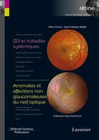 Oeil et maladies systémiques / Anomalies et affections non glaucomateuses du nerf optique
