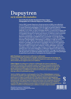 Dupuytren